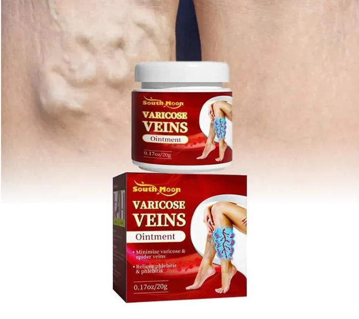 🦵✨ “Reduce visiblemente las várices y recupera la belleza de tus piernas”