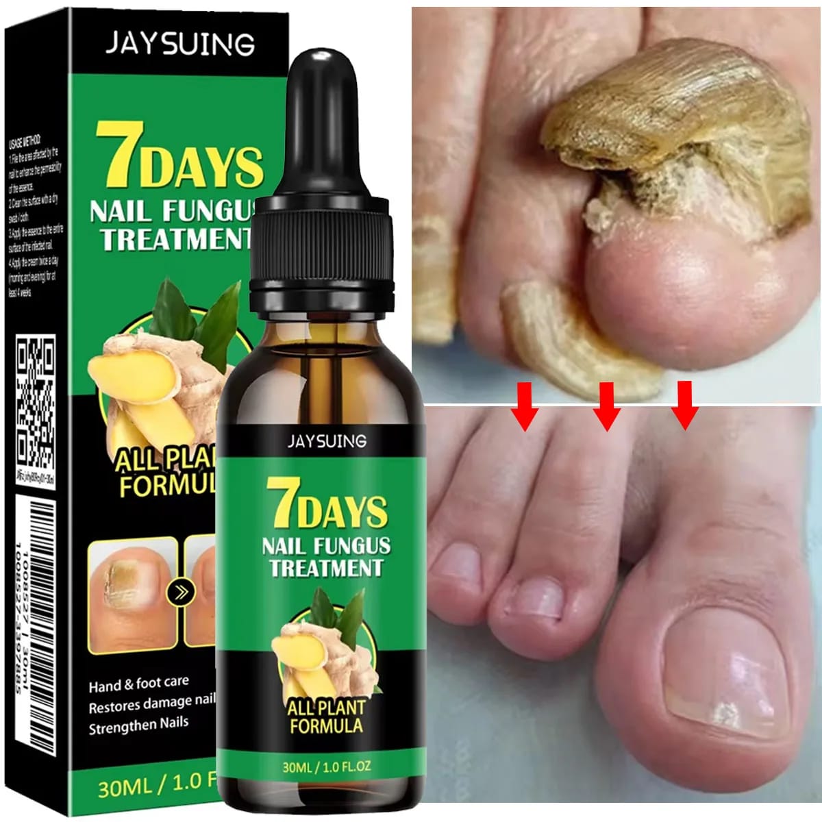 🦶✨ Recupera tus uñas en 7 días y deja de esconder tus pies para siempre.  🌿 Actúa desde la primera aplicación eliminando hongos visibles y ocultos, ayudándote a lograr uñas limpias en solo 7 días y la seguridad de volver a mostrarlas sin vergüenza